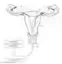 Fig. 01 - Systems and methods for permanent female contraception