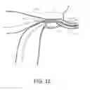 Fig. 06 - Systems and methods for permanent female contraception