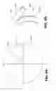 Fig. 07 - Method and apparatus for inserting an implant in the cornea of the eye