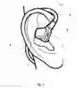 Fig. 03 - EARPIECE