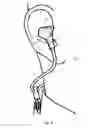 Fig. 05 - EARPIECE