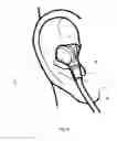 Fig. 07 - EARPIECE