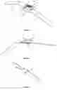 Fig. 02 - FEEDBACK ELECTRO HEMOSTATIC COMPRESSION PAD