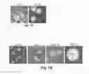 Fig. 02 - Isolation of human neural stem cells from amniotic fluid of patients with neural tube defects