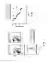 Fig. 20 - COMPOSITIONS AND METHODS FOR THE PREVENTION AND TREATMENT OF AUTOIMMUNE CONDITIONS