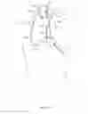 Fig. 02 - Methods and systems for establishing retrograde carotid arterial blood flow