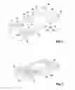 Fig. 02 - Implantable Medical Device and Manufacturing Method Therefor