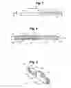 Fig. 03 - Extrusion die having adjustable end seal system and method of use