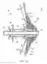 Fig. 17 - CASSETTE AND BICYCLE WHEEL ASSEMBLY