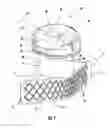 Fig. 02 - Dispensing closure