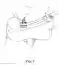 Fig. 02 - SMART SADDLE APPARATUS