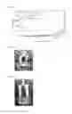 Fig. 02 - Hydrogel forming composition and hydrogel formed thereof