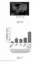 Fig. 43 - Generating definitive endoderm and pancreatic progenitor cells