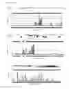 Fig. 02 - Method of diagnosing bladder cancer