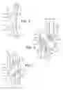 Fig. 03 - Recirculation crossover insert and linear motion assembly therewith