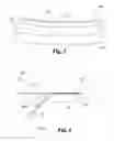 Fig. 03 - Arcuate saddles with adhesive strips