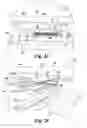 Fig. 21 - Arcuate saddles with adhesive strips