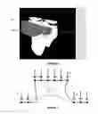 Fig. 04 - Method for constructing a patient-specific surgical guide
