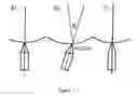 Fig. 02 - Method for reducing the swinging of ships, anchored or moored to a buoy, and device for the implementation thereof