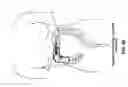 Fig. 71 - Method and apparatus for manipulating the side wall of a body lumen or body cavity so as to provide increased visualization of the same and/or increased access to the same, and/or for stabilizing instruments relative to the same