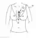 Fig. 01 - Extended wear electrocardiography patch