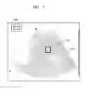 Fig. 08 - APPARATUS AND METHOD OF MEASURING ELASTICITY USING ULTRASOUND