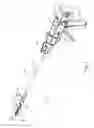 Fig. 02 - Malleable bioabsorbable polymer adhesive for releasably attaching a staple buttress to a surgical stapler