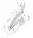Fig. 22 - Malleable bioabsorbable polymer adhesive for releasably attaching a staple buttress to a surgical stapler