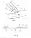 Fig. 02 - Removal tool for use with endoscopic device