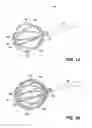 Fig. 02 - A BASKET CATHETER AND METHOD OF MANUFACTURING