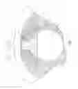 Fig. 02 - Surgical implant