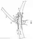 Fig. 07 - Procedures for vascular occlusion
