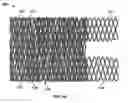 Fig. 16 - Procedures for vascular occlusion