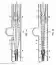 Fig. 44 - Procedures for vascular occlusion