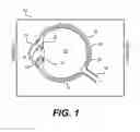 Fig. 02 - Modular intraocular lens designs and methods