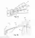Fig. 02 - Pre-sized prosthetic chordae implantation system