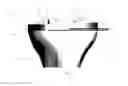 Fig. 07 - Stepped tibial baseplate