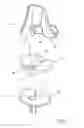 Fig. 02 - Knee joint prosthesis