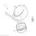 Fig. 02 - GLENOSPHERE-IMPLANT POSITIONING DEVICE AND METHOD