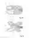 Fig. 07 - Expandable spinal implant