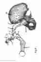 Fig. 06 - SET OF INSTRUMENTS FOR THE IMPLANTATION OF AN ACETABULAR PROSTHESIS