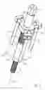 Fig. 02 - INSTRUMENT SET FOR REMOVING A MODULAR CERAMIC HIP-JOINT IMPLANT