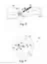 Fig. 07 - Surgical instrument and method of positioning an acetabular prosthetic component