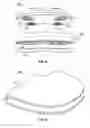 Fig. 07 - Balancing device for arthroplasty and methods for use