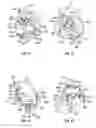 Fig. 33 - Balancing device for arthroplasty and methods for use