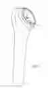 Fig. 02 - Modular humeral implant