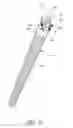 Fig. 16 - Modular humeral implant