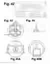 Fig. 35 - Electronically controlled prosthetic system