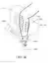 Fig. 43 - MODULAR PROSTHETIC DEVICES AND PROSTHESIS SYSTEMS