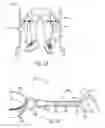 Fig. 08 - Limiting dynamic cord for an orthosis or prosthesis or walker